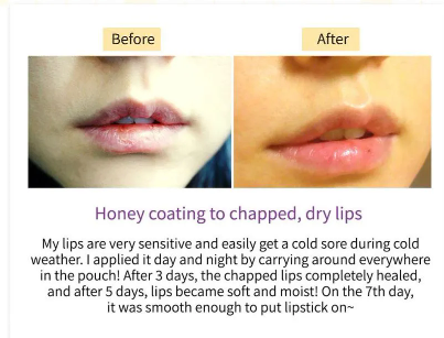Best Beauty Group - FRUIDA Hydrating Honey Lip Balm: Blueberry Hydrating